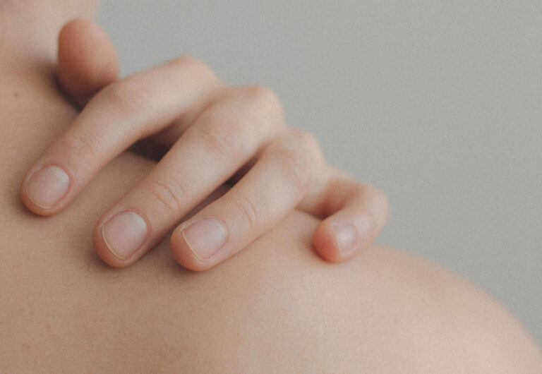 a close up of skin
